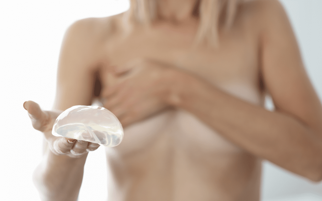 Explante mamario: cuando menos es más