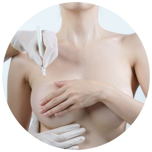 Operacion mama tuberosa