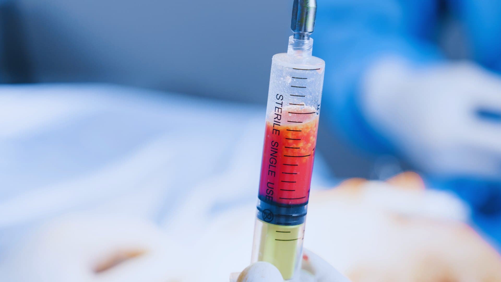 Lipofilling - Aumento de pecho natural