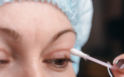Cuidados, cicatrización y recuperación después de la blefaroplastia