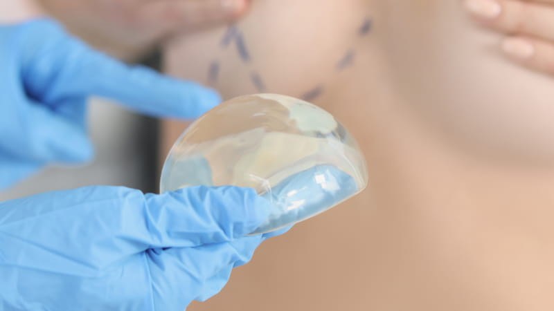 mastopexia implantes