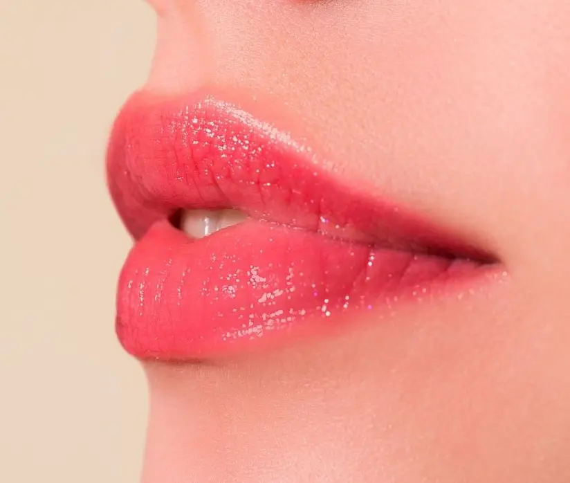 Queiloplastia-madrid